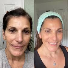 Benefits of not bathing daily for skin