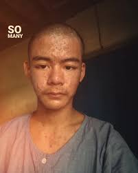 Forever Young Lewis Trend