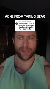 Steroid Acne Bodybuilder