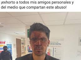 Están niña hace que mis días sean más felices , me hace crecer como persona , lucha mis batallas a mi lado , y más importante q nada sabe cómo hacerme sonreír ! Bbgwxzlxrpyqxm