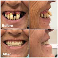 We did not find results for: Dentures Ottawa Denture Clinic Denturist Rockcliffe Dental