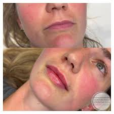 Kent Beauty & Aesthetics