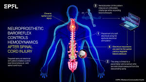 Most backbone application examples that you find on the web are very small and very simple. New Treatment Helps Patients With A Spinal Cord Injury Eurekalert Science News