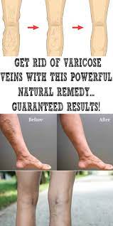 Pin On Health Tips For Women
