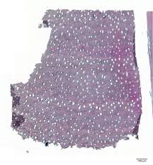 Image result for Dalbergia boehmii