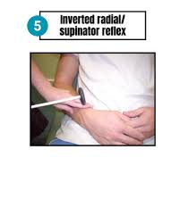 Image result for Supinator Reflex