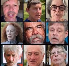 Which of these celebs suffers from TDS the most?