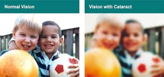 We did not find results for: Cataract Surgeons Sydney Chatswood Eye Surgeons