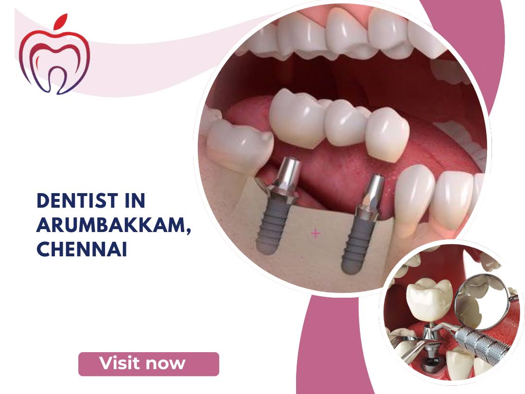 Dentist in Arumbakkam, Chennai product image