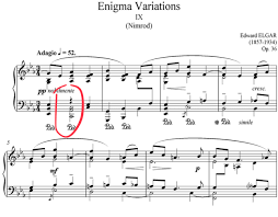 This means that we can combine notes and rests into the same bar. Why You Need A Rest Here In This Score Music Practice Theory Stack Exchange