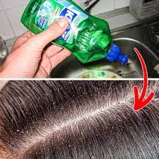 Youtubers insist you must use the blue version of dawn soap to wash your hair, when really this is just the original scent version. 12 Things You Should Never Wash With Dish Soap