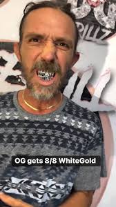 GleefullGrillz snappin 🔥 🔥 🔥