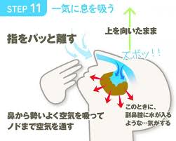 副鼻腔炎 蓄膿症の膿をスッキリ出して楽になりたい 自己流 吸引鼻うがい たまごごはん 副鼻腔炎 副鼻腔 膿