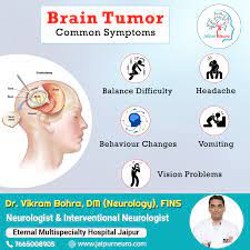 Brain Tumor Common Symptoms Neurologist Neurologist Doctors Brain Hemorrhage