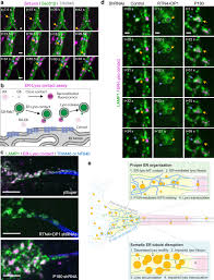 You can get your learners to provide labels for the. Er Lysosome Contacts At A Pre Axonal Region Regulate Axonal Lysosome Availability Nature Communications