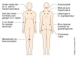 Er du rammet av smerter i øvre del av låret? Sykdommer Som Kan Gi Store Smerter Nhi No