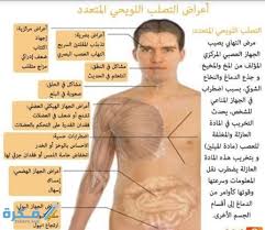 الأمراض العصبية هي أمراض تتسبب في الاضطراب في أحد أجزاء الجهاز العصبي، فيطال تأثيره الدماع والحبل الشوكي مسببًا تلف. Ù…Ø§ Ù‡Ùˆ Ù…Ø±Ø¶ Ø§Ù„ØªØµÙ„Ø¨ Ø§Ù„Ù„ÙˆÙŠØ­ÙŠ Ù…ÙˆÙ‚Ø¹ ÙÙƒØ±Ø©