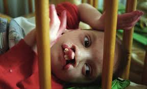 While the wilderness itself is portrayed as a far greater threat, the film's human villains, a pair of. Chernobyl Child Mutations Chernobyl Disaster Guide