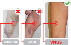 Ceaiul de păpădie este unul dintre cele mai puternice detoxifiante naturale. Detralex Pentru Circulatia Sangelui