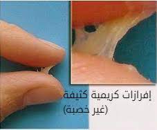 إفرازات التبويض وفترة الخصوبة بالصور بيتي بيديا