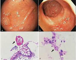 Image result for Eriocoelum