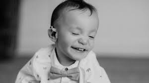 Our Child Might Be 'Differently Abled,' but That Doesn't Mean We've Lost  Hope