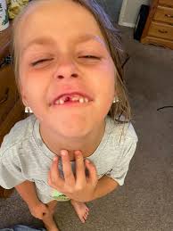 Maple got her tooth out with some kisses💕🐷