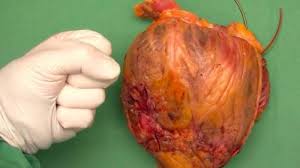 Cauzele atacurilor de panică și tulburări de panică, care descriu persoanele care au atacuri frecvente, pot varia foarte mult. Tot Ce Trebuie SÄ Ètii Despre Atacul De PanicÄ