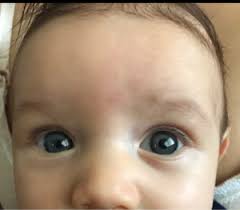 The fact that you were able to spot so many colors says that your eyesight is pretty darn impressive! 2 Different Colored Eyes May 2017 Babies Forums What To Expect