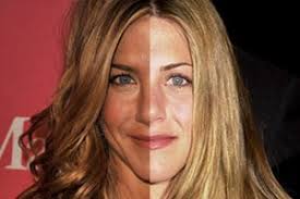 As the saying goes, eyes are the window to the soul, so it is important to keep them as sharp and clear as possible. Best And Worst Celebrity Plastic Surgery