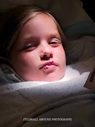 9-year-old girl bitten by dog takes responsibility for startling it