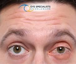 Image result for Blepharis bainesii