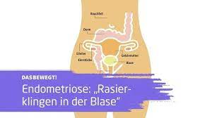 Endometriose Schmerzen Wie Rasierklingen In Der Blase