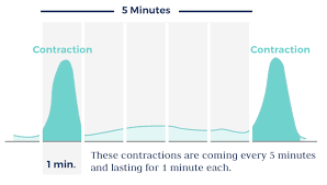 How long do contractions last? Timing Contractions What You Need To Know Bloomlife