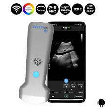 The extracranial doppler sonography examines potential constrictions and occlusions of the carotid arteries. Color Doppler Wifi Convex Ultrasound Scanner Sifultras 5 28
