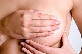 Flaps used for breast reconstruction most often come from the abdomen or back. Reconstruction Mammaire Une Technique Definitive Et Sans Implant