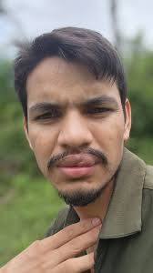 Cat with missing tooth and snarl photo discussion