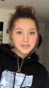 Natural Beauty: Embracing My Acne-Prone Skin