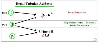 Reported anonymously by rta medical supply employees. Renal Tubular Acidosis Renal Acidosis Medical Mnemonics