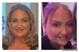 AND WE HAVE ANOTHER ONE.... The incredible Karla !!!! What a woman she is  !! "2 YEARS!! We don't count the days, we make the days count! However, you  never forget the