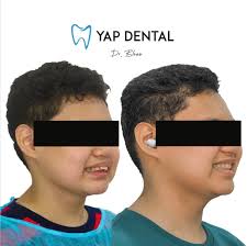 פרופיל של ‏‎Yap Dental‎‏‎