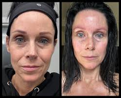 Only 2 months of using my Riman skin care line and my wrinkles are slowly  disappearing, my skin is healthier and not dry and it's so dang soft! Thank  you Kandee Gale