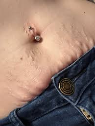 to a 0 gauge now. Septum