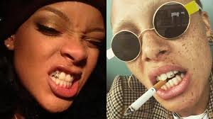 Diamantes en los dientes? Los peligros de esta extravagante tendencia