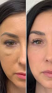 Kristi’s Case Part 3: The Final Reveal ✨, After an incredibly challenging  journey, we’re thrilled to finally reveal Kristi’s beautiful  transformation! 🌟, In Parts 1 and 2, we walked you through her ...