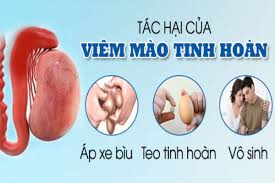 dấu hiệu viêm tinh hoàn thường gặp ở nam giới