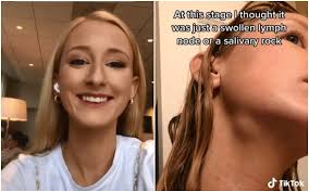 Helen Bender: Descubrió que tenía cáncer en etapa 4 gracias a un truco de  belleza que vio en TikTok