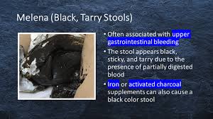 Image result for blood in stool human poop