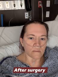 Liquid diet recipe before surgery