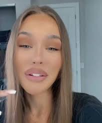 Neue fotos enthüllen die dreiste wahrheit. Laura Mullers Neues Gesicht Gefallt Das Dem Wendler Beauty Op Oder Filter Leute Bild De